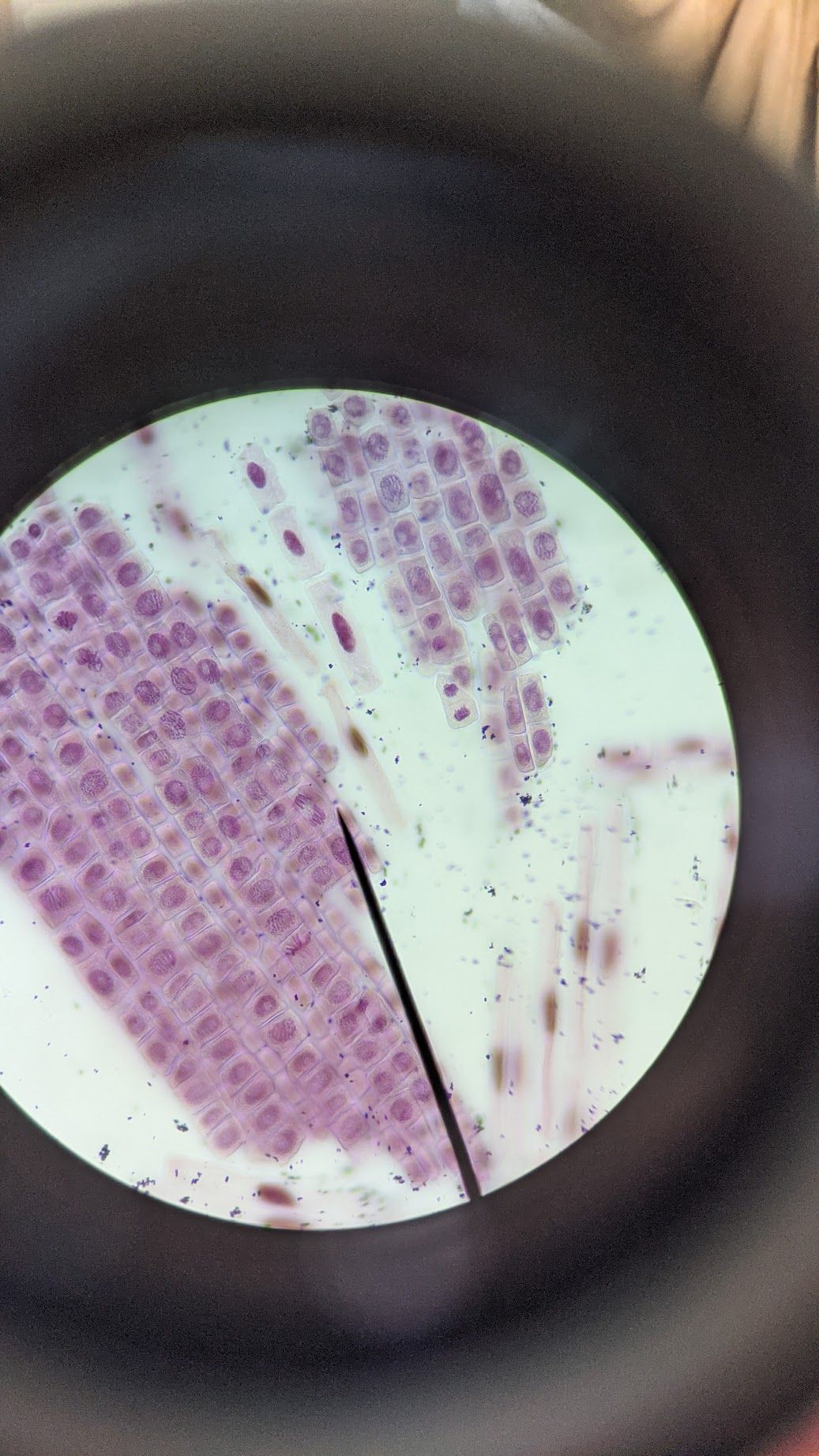 MITOSISCEBOLLA